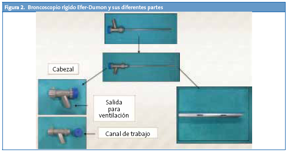 Figura 2. Broncoscopio rígido Efer-Dumon y sus diferentes partes