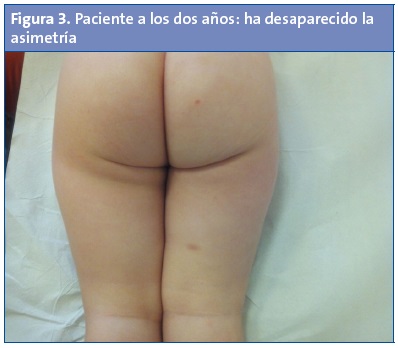 Figura 3. Paciente a los dos años: ha desaparecido la asimetría.