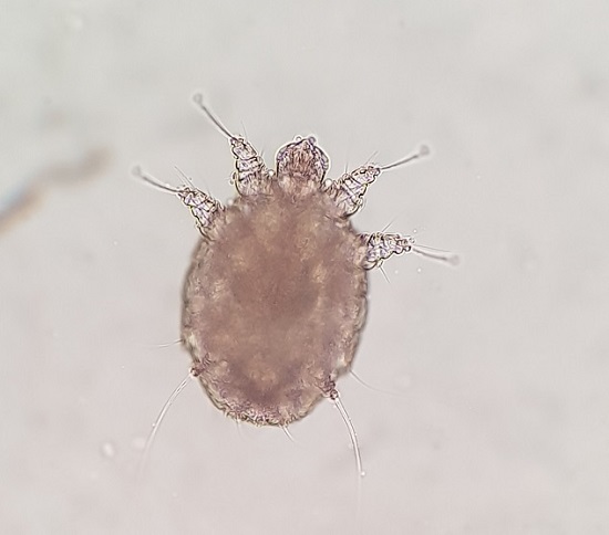 Figura 3. Visión directa de microscopía óptica (×200). Se aprecia el ácaro hembra de Sarcoptes scabiei, con un cuerpo ovoide provisto de 4 pares de patas apéndices 