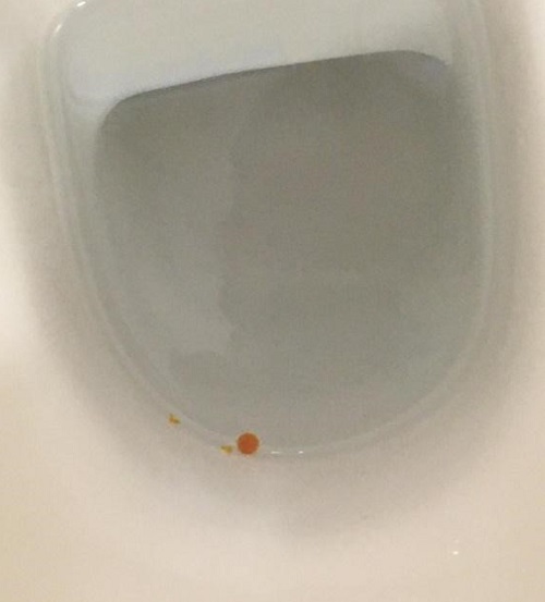 Figura 1. Diarrea oleosa anaranjada