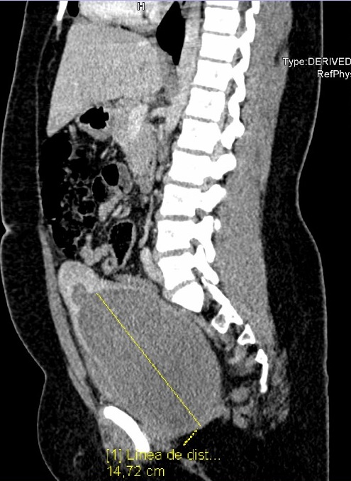 Figura 1. Tomografía computarizada
