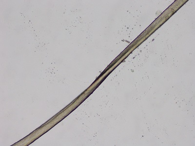 Figura 2. Cabello impeinable. Estudio del pelo mediante microscopía óptica: pili canaliculi