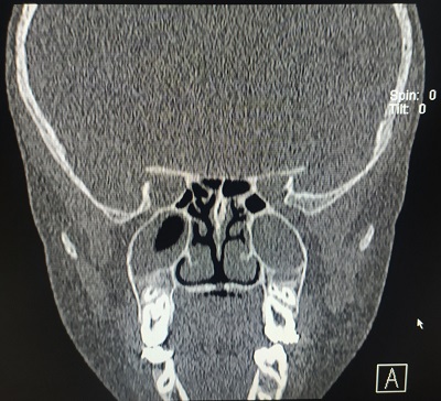 Figura 1. Imagen de la tomografía axial computarizada.