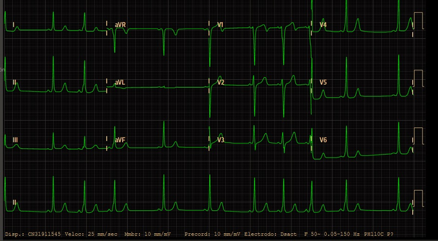Figura 1. Electrocardiograma