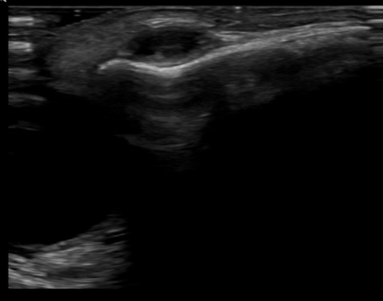 Figura 1. Ecografía