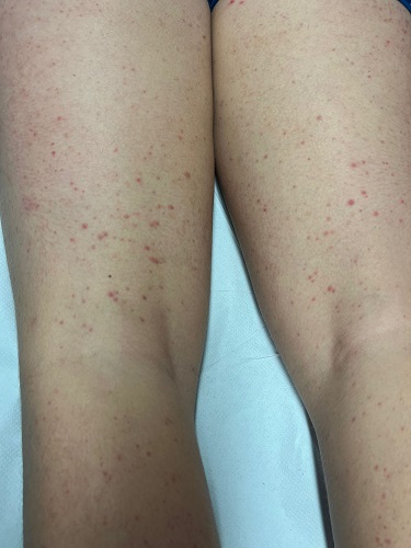 Figura 1. Lesiones dérmicas 