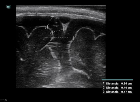 Figura 1. Ecografía