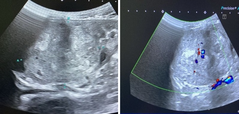 Figura 1. Pruebas de imagen