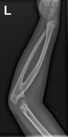 Figura 1. Radiografía