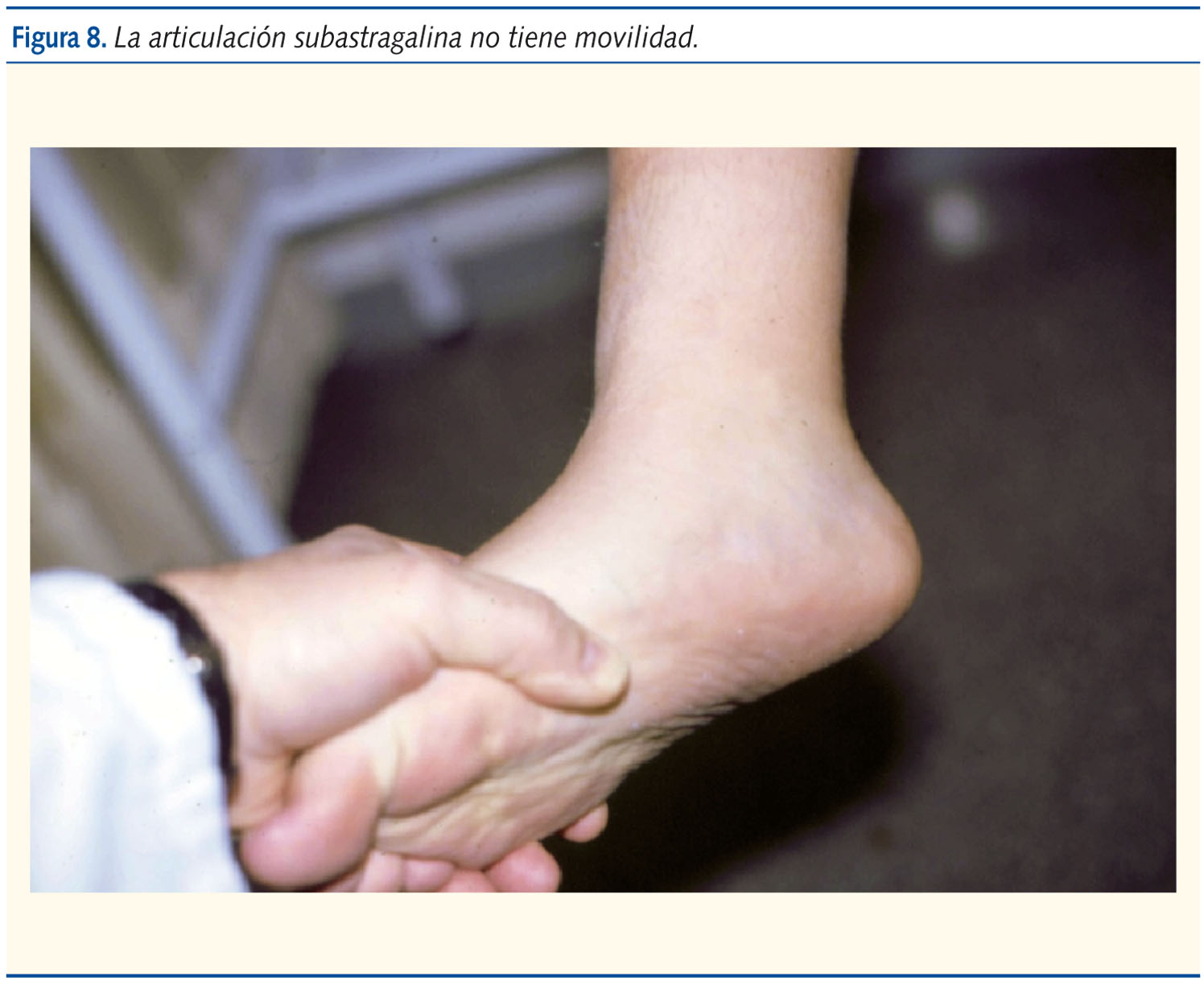 Figura 8. La articulación subastragalina no tiene movilidad.