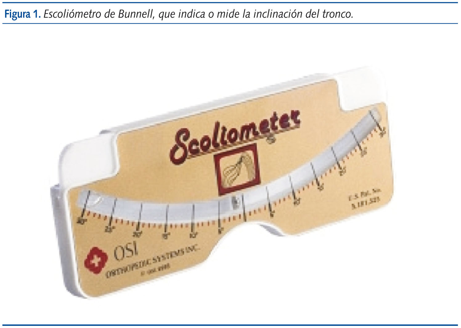 Figura 1. Escoliómetro de Bunnell, que indica o mide la inclinación del tronco.