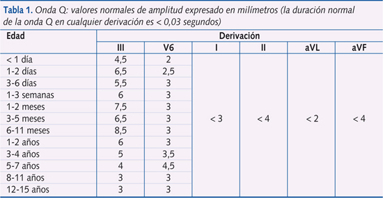 Tabla 1. Onda Q: valores normales de amplitud expresado en milímetros (la duración normal de la onda Q en cualquier derivación es < 0,03 segundos)