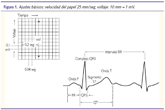 Figura 1. Ajustes básicos: velocidad del papel 25 mm/seg; voltaje: 10 mm = 1 mV