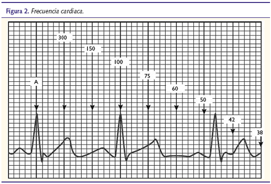 Figura 2. Frecuencia cardiaca